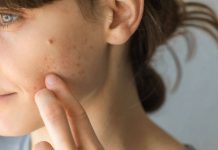 Cum sa aveti grija de microbiota pielii?